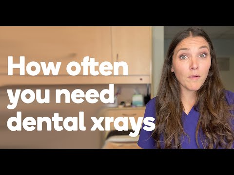 How often do you really need X-rays?