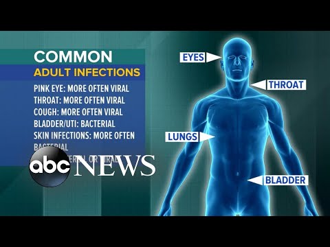 The disturbing findings on overuse of antibiotics