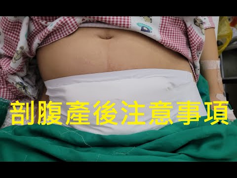 聖保祿醫院剖腹產後護理指導