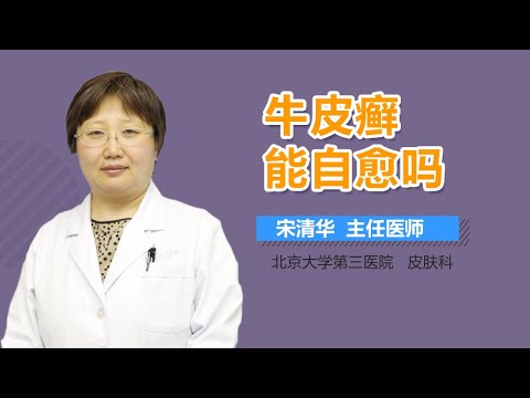 牛皮癣能自愈吗 牛皮癣会不会自我恢复 有来医生