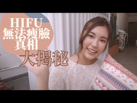 【美容真相】為何打HIFU／無針埋線無效果？不能瘦臉嗎？